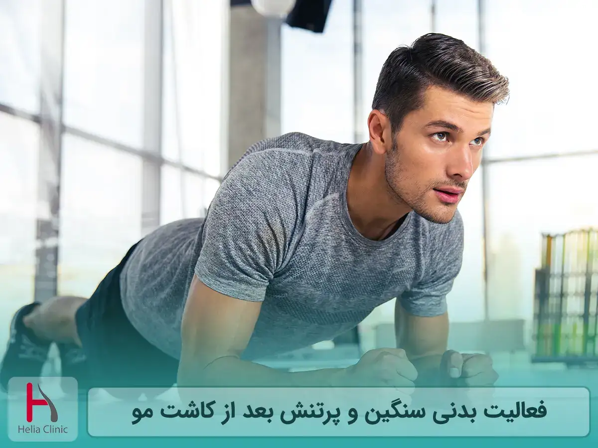 فعالیت بدنی سنگین و پرتنش بعد از کاشت مو