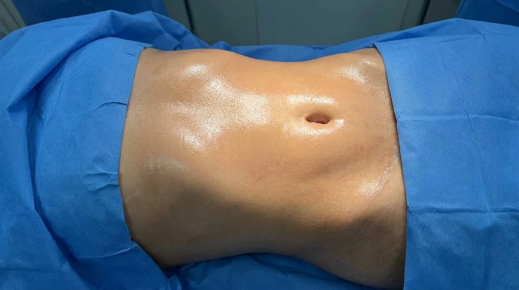 Body Plastic Surgery & Contouring