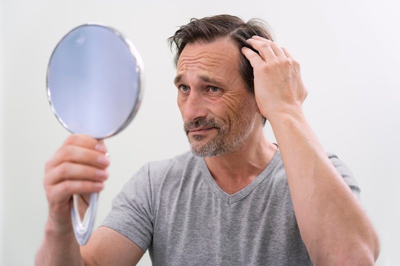 Age and hair loss pattern