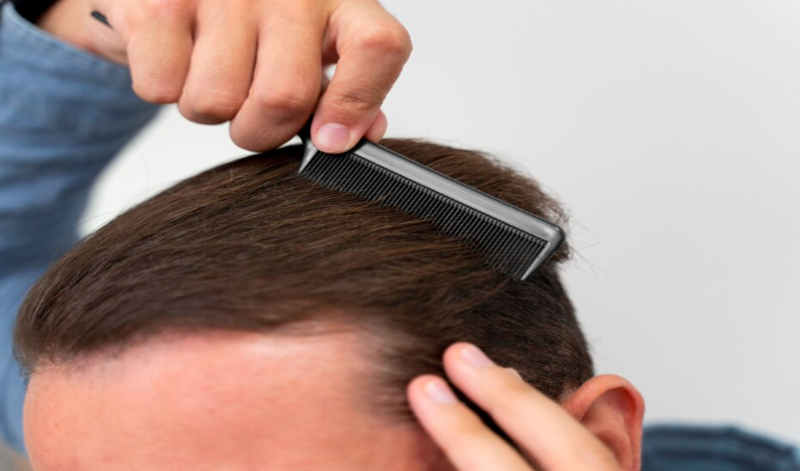 Care Before and After Hair Transplant: A Step-by-Step Guide