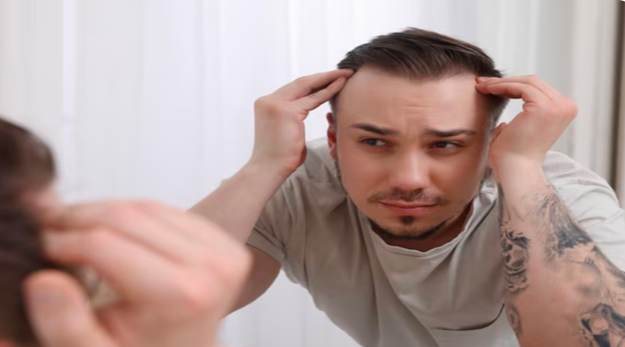 Side Effects of Hair Transplant: What to Expect and How to Manage