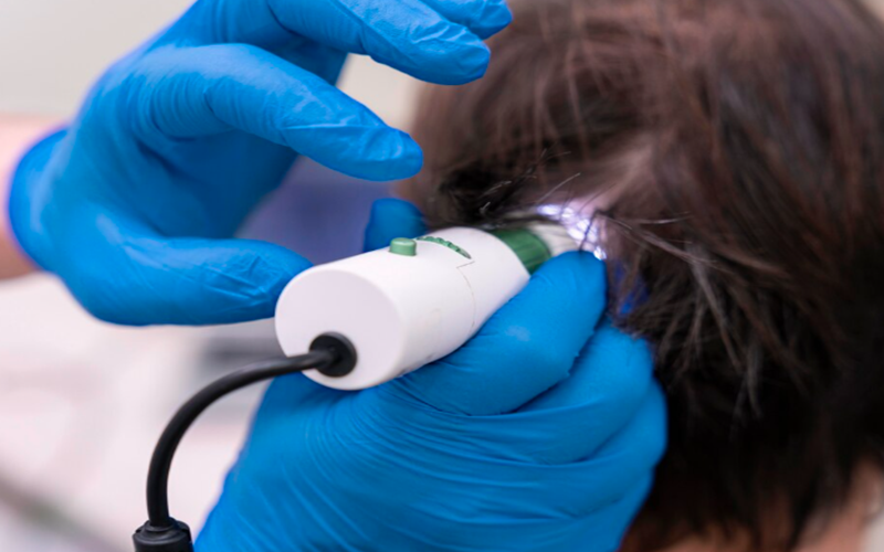 Hair Transplant Prices 2026: Find Your Perfect Match