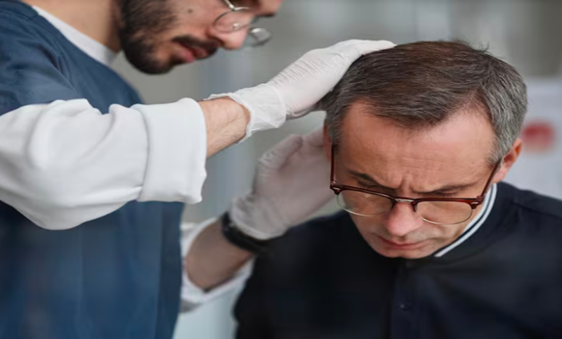 The Donor Area: The Lifeline Zone of Hair Restoration