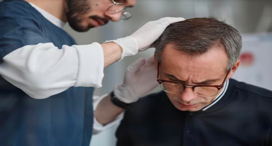 The Donor Area: The Lifeline Zone of Hair Restoration