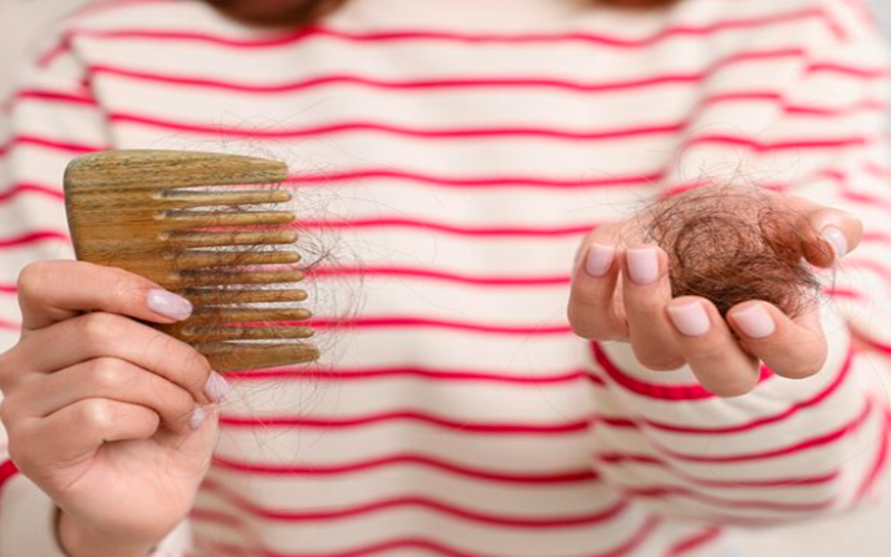 The Hair Loss Guide: From Causes to Treatments