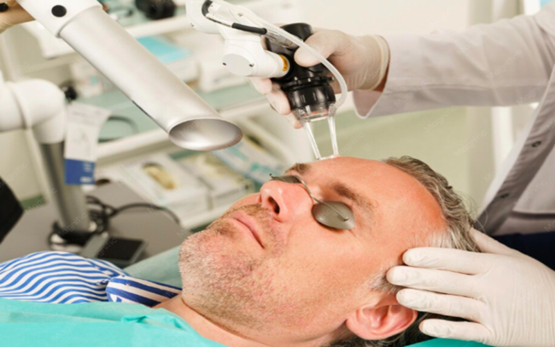 ARTAS Robotic Hair Transplant: Precision Control and Minimally Invasive