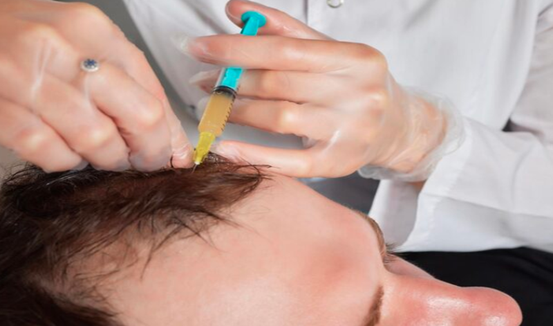 Body Hair Transplant (BHT): Unlock More Donor Options