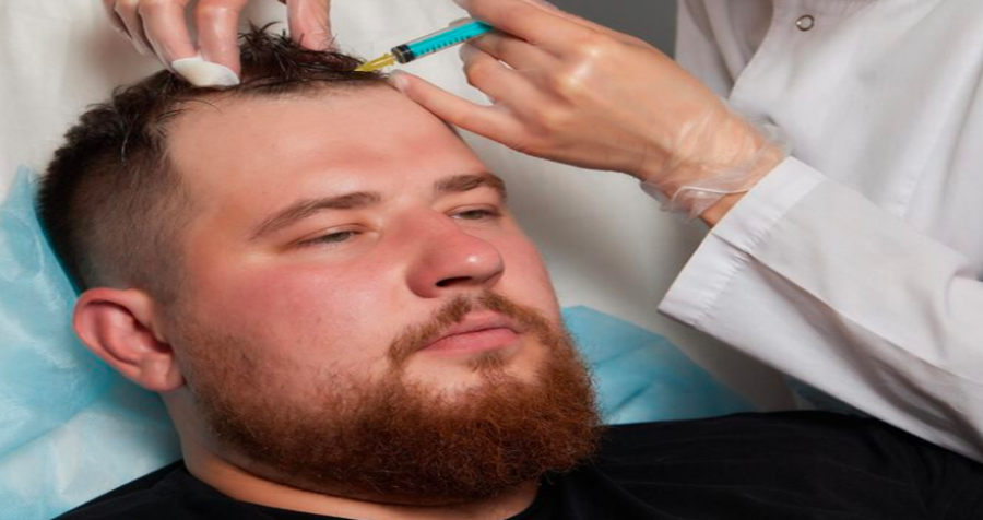 NeoGraft Hair Transplant: A Realistic Look