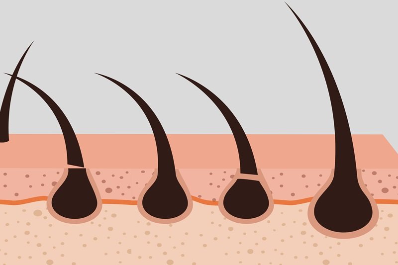 Non-Surgical Hair Transplant and Hair Follicle Structure