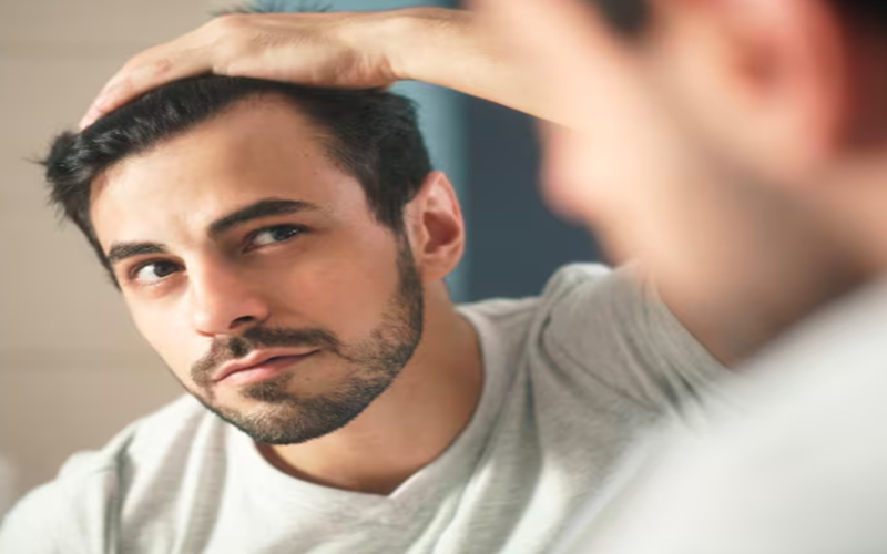 Dandruff After Hair Transplant? Conquer Flakes with Our Tips