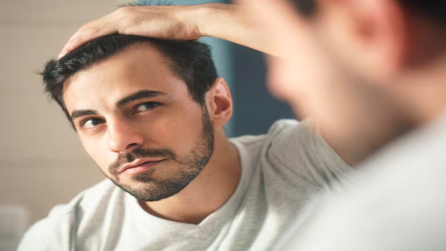 Dandruff After Hair Transplant? Conquer Flakes with Our Tips