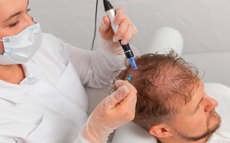 Hair Transplant in Dubai: Best Surgeon, Top Rated Clinic