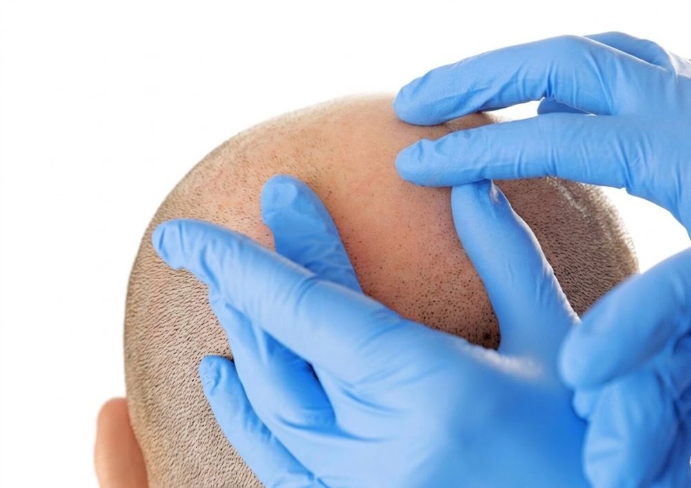 treatment plan, graft planning, procedure details, safety standards,