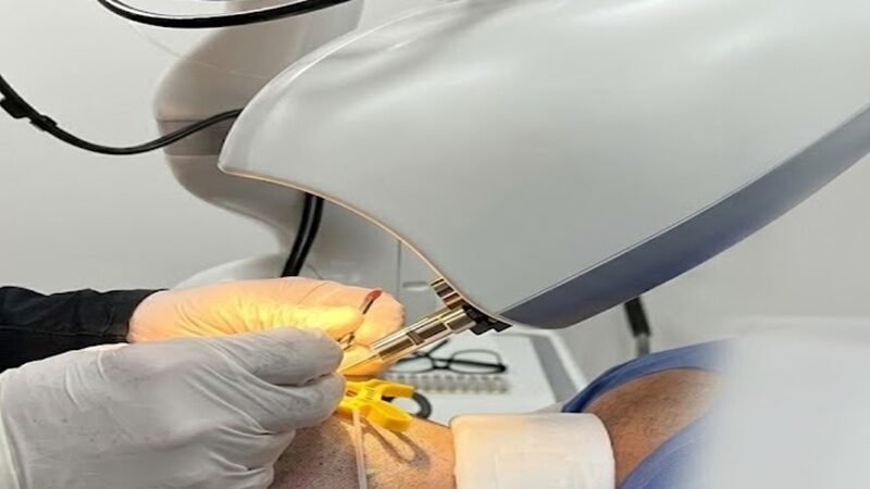 Robotic vs Manual Hair Transplant: Can Robots Really Do It Better?