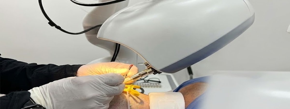 Robotic vs Manual Hair Transplant: Can Robots Really Do It Better?