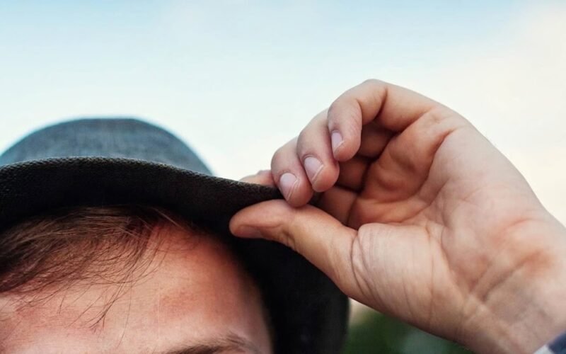 Is a Hair Transplant Worth It? Long-Term Cost vs Results Analysis