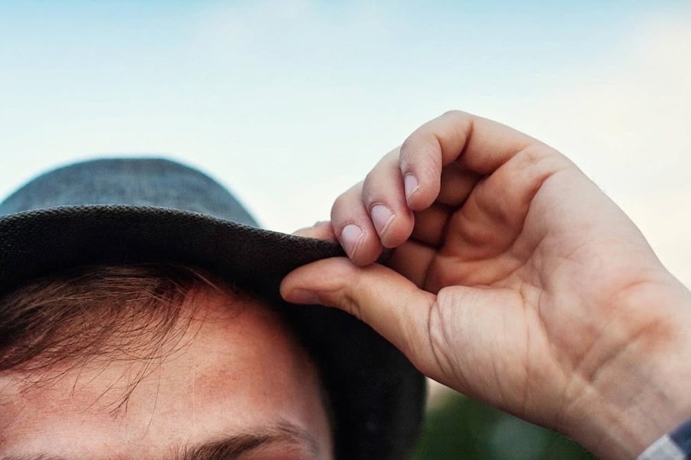 Is a Hair Transplant Worth It? Long-Term Cost vs Results Analysis