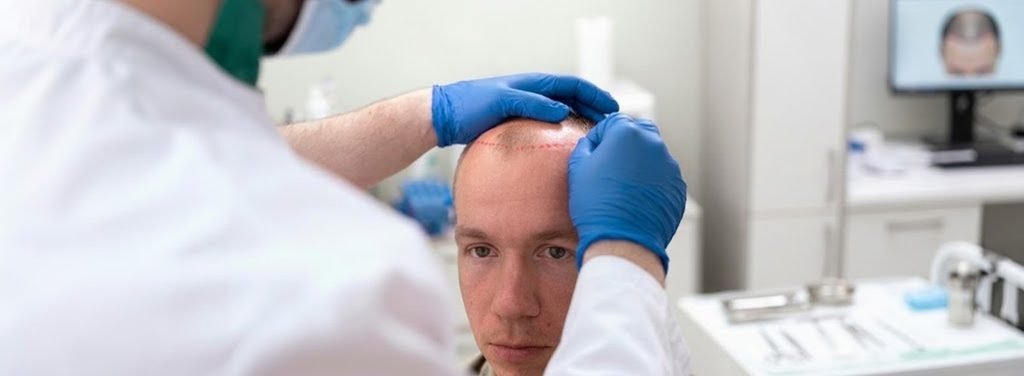 the choice between robotic and manual hair transplantation