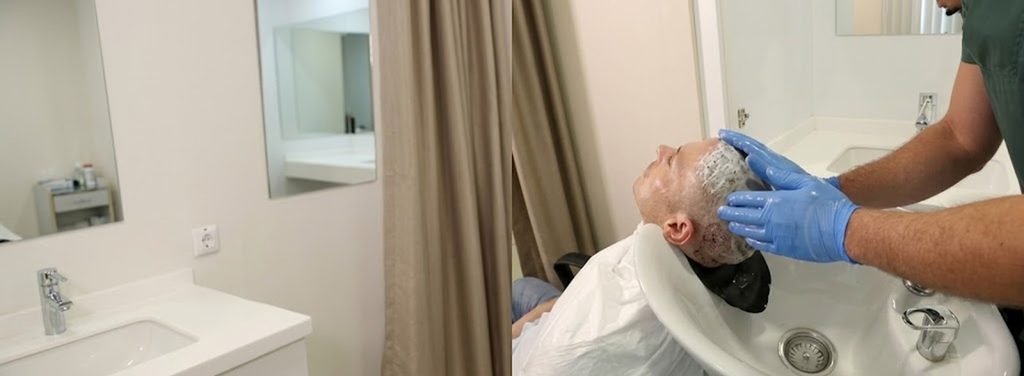 Your first wash after hair surgery should be much gentler than your normal hair-washing routine