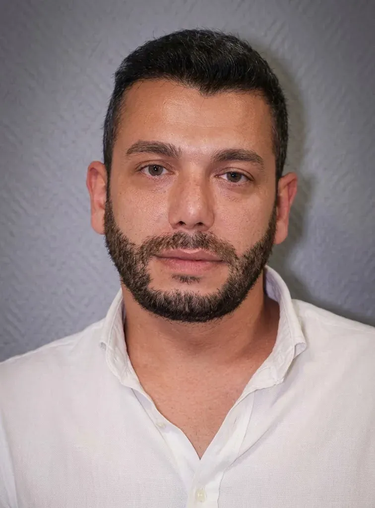 After beard and mustache transplant at Helia Clinic Dubai — full natural beard growth result.