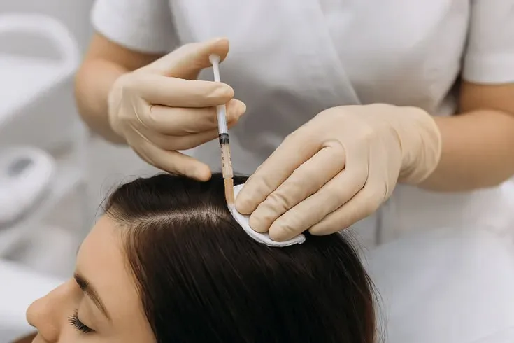 Male PRP hair treatment at Helia Clinic Dubai — mesotherapy injection gun delivering platelet-rich plasma.
