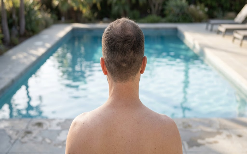 When Can You Swim After a Hair Transplant?