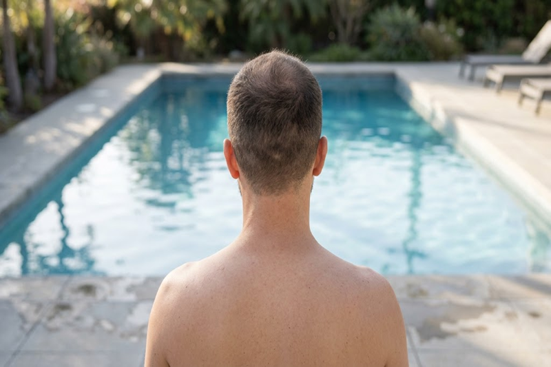 When Can You Swim After a Hair Transplant?