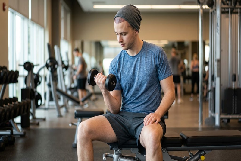 Exercise After Hair Transplant: When Can You Work Out?