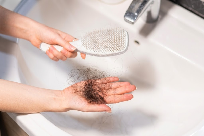 Sudden extensive hair shedding associated with anagen effluvium