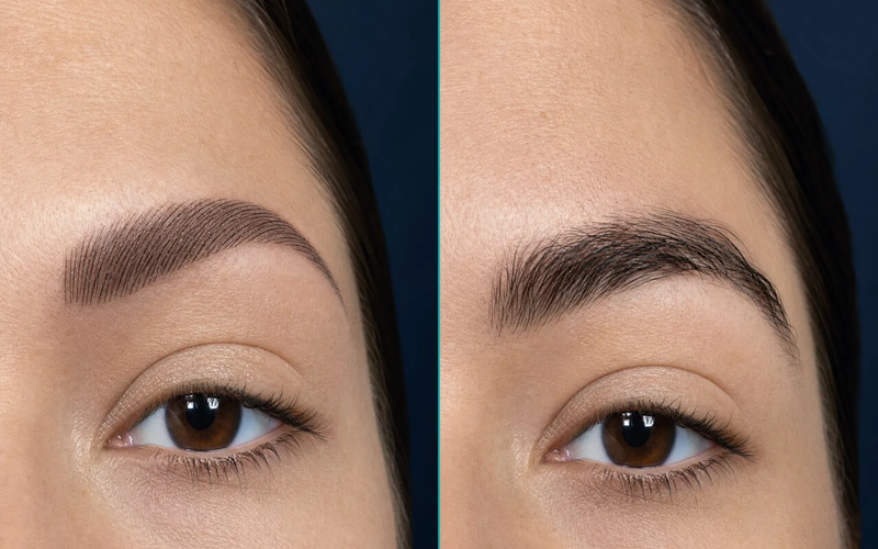 Eyebrow Transplant vs Microblading: Natural & Long-Lasting Results