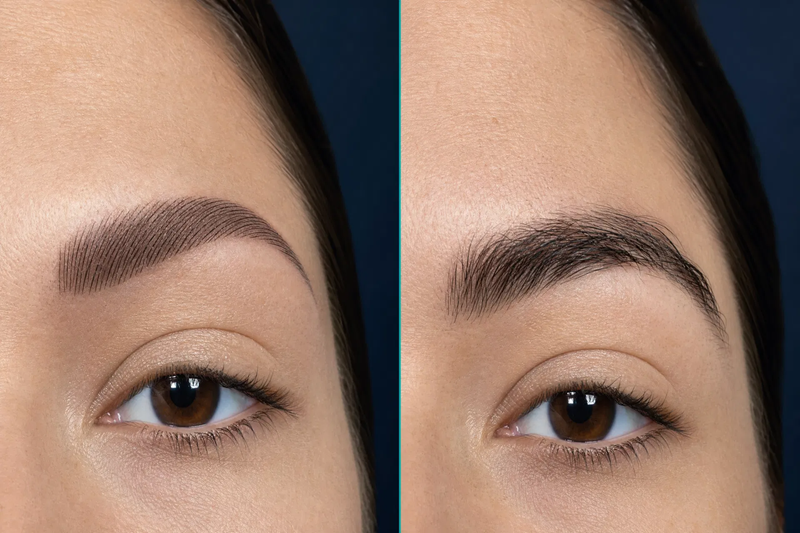 Eyebrow Transplant vs Microblading: Natural & Long-Lasting Results