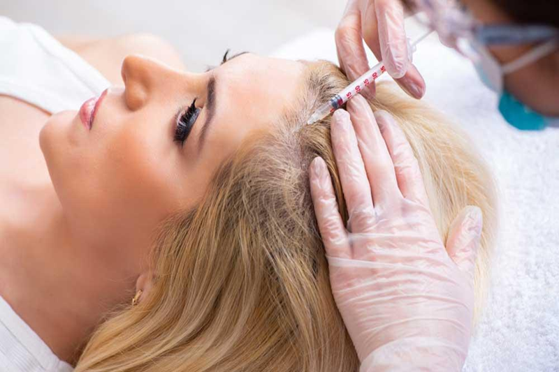 prp treatment