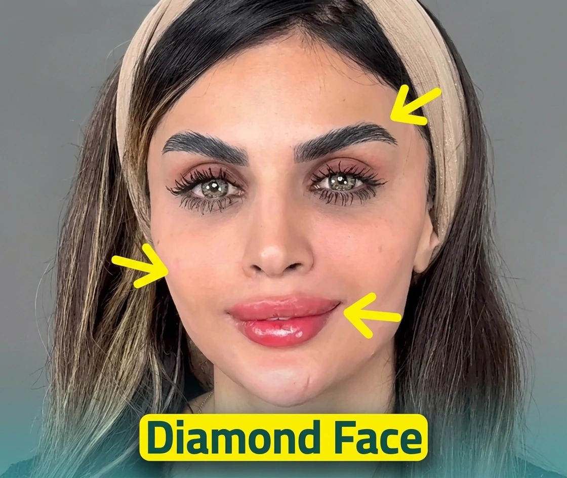 Model demonstrating Diamond Face contouring treatment areas with yellow arrows pointing to brows, cheekbones, and lips.